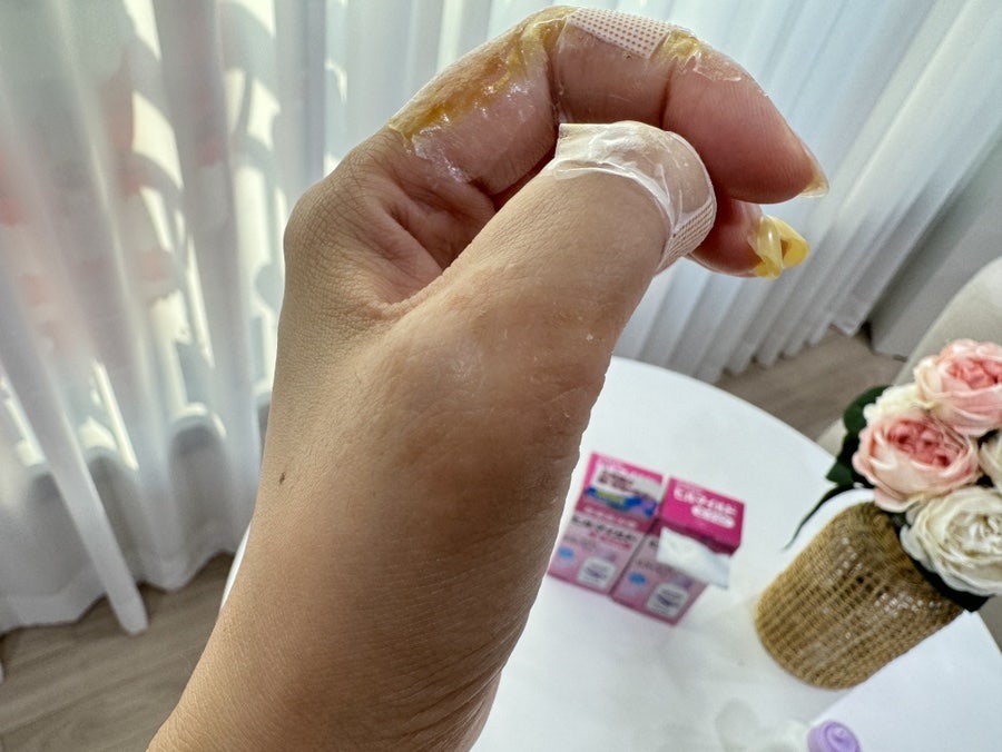 Dry hands